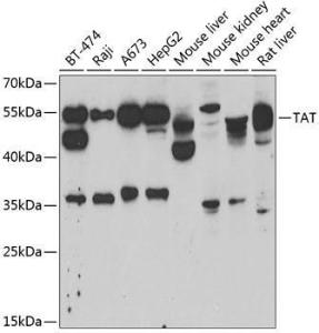 Western blot analysis of extracts of various cell lines, using Anti-ATTY Antibody (A9991) at 1:1,000 dilution. The secondary antibody was Goat Anti-Rabbit IgG H&L Antibody (HRP) at 1:10,000 dilution.