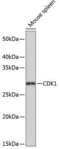 Western blot analysis of extracts of Mouse spleen, using Anti-CDK1 Antibody [ARC50607] (A305462) at 1:1,000 dilution. The secondary antibody was Goat Anti-Rabbit IgG H&L Antibody (HRP) at 1:10,000 dilution.