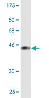 Anti-PIP5K1C Mouse Monoclonal Antibody [clone: 2E9]