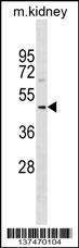 Anti-SUDS3 Rabbit Polyclonal Antibody (AP (Alkaline Phosphatase))