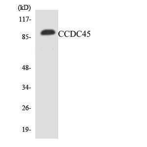 Western blot analysis of the lysates from Jurkat cells using Anti-CCDC45 Antibody