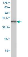 Anti-GRHL3 Mouse Monoclonal Antibody [clone: 3C5]