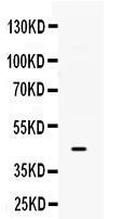 Anti-B3GNT8 Rabbit Polyclonal Antibody