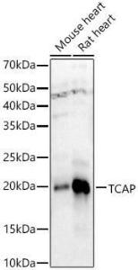 Western blot analysis of extracts of various cell lines, using Anti-Telethonin Antibody (A9992) at 1:400 dilution. The secondary antibody was Goat Anti-Rabbit IgG H&L Antibody (HRP) at 1:10,000 dilution.