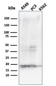 Western blot analysis of (Lane 1) A549 cell line lysate, (Lane 2) PC3 cell line lysate, and (Lane 3) K562 cell line lysate using Anti-NME1 Antibody [NME1/2738]