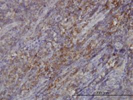 Anti-RASGRP4 Mouse Monoclonal Antibody [clone: 1F3]