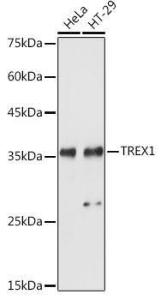 Western blot analysis of extracts of various cell lines, using Anti-TREX1 Antibody (A9994) at 1:1,000 dilution