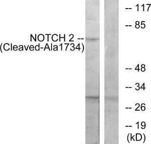 Western blot analysis of lysates from Jurkat cells, treated with etoposide 25uM 24h using Anti-NOTCH2 (cleaved Ala1734) Antibody. The right hand lane represents a negative control, where the antibody is blocked by the immunising peptide.