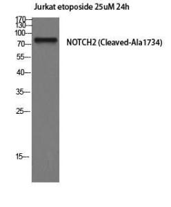 Western blot analysis of Jurkat cells using Anti-NOTCH2 (cleaved Ala1734) Antibody