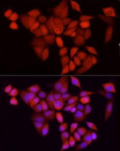 Immunofluorescence analysis of HeLa using Anti-CDK1 Antibody [ARC50607] (A305462) at a dilution of 1:100 (40x lens). DAPI was used to stain the cell nuclei (blue).