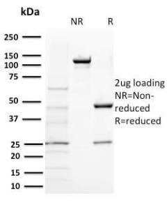 SDS-PAGE analysis of Anti-BAP1 Antibody [BAP1/2431] under non-reduced and reduced conditions; showing intact IgG and intact heavy and light chains, respectively SDS-PAGE analysis confirms the integrity and purity of the antibody