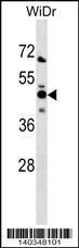 Anti-NMI Rabbit Polyclonal Antibody (AP (Alkaline Phosphatase))