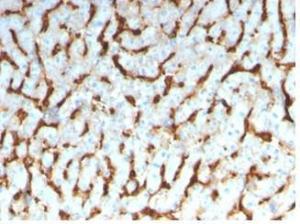 Immunohistochemical analysis of formalin-fixed, paraffin-embedded human liver tissue using Anti-Apolipoprotein D Antibody [APOD/3413]