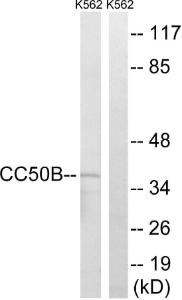 Anti-TMEM30B antibody