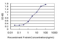 Anti-RASGRP4 Mouse Monoclonal Antibody [clone: 1F3]