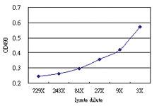 Anti-ODC Antibody Pair