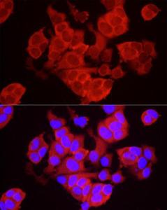 Immunofluorescence analysis of MCF7 cells using Anti-TREX1 Antibody (A9994) at a dilution of 1:50 (40X lens). DAPI was used to stain the cell nuclei (blue)