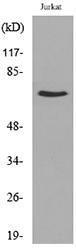 Western blot analysis of lysate from Jurkat cells using Anti-NFκB-p65 (acetyl Lys218) Antibody