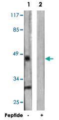 Anti-VDR Rabbit Polyclonal Antibody