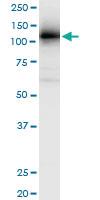 Anti-RNF20 Polyclonal Antibody Pair