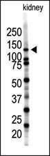 Anti-SENP7 Rabbit Polyclonal Antibody (AP (Alkaline Phosphatase))