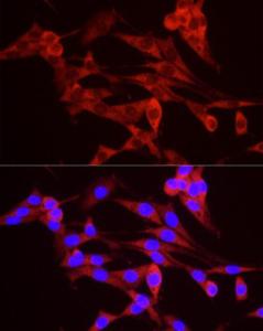 Immunofluorescence analysis of PC-12 cells using Anti-TREX1 Antibody (A9994) at a dilution of 1:50 (40X lens). DAPI was used to stain the cell nuclei (blue)