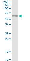 Anti-MMP20 Rabbit Polyclonal Antibody