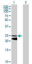 Anti-NFAM1 (NFAT activating Protein with ITAM motif 1) Mouse Polyclonal Antibody