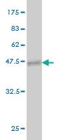 Anti-PIP5K1C Mouse Monoclonal Antibody [clone: 7D11]