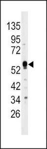 Anti-DUSP4 Rabbit Polyclonal Antibody (APC (Allophycocyanin))