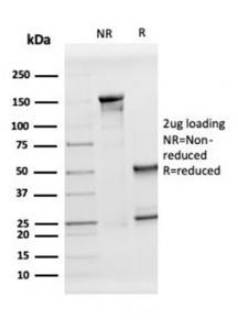 SDS-PAGE analysis of Anti-Apolipoprotein D Antibody [APOD/3413] under non-reduced and reduced conditions; showing intact IgG and intact heavy and light chains, respectively. SDS-PAGE analysis confirms the integrity and purity of the antibody.