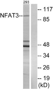 Anti-NFAT3 antibody