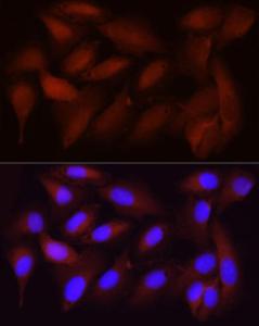 Immunofluorescence analysis of U2OS using Anti-CDK1 Antibody [ARC50607] (A305462) at a dilution of 1:100 (40x lens). DAPI was used to stain the cell nuclei (blue).