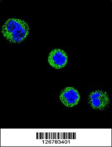 Anti-CD1E Rabbit Polyclonal Antibody (AP (Alkaline Phosphatase))