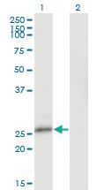 Anti-NFAM1 Mouse Monoclonal Antibody [clone: 2E9]