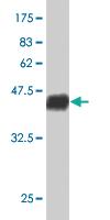 Anti-RAX Mouse Monoclonal Antibody [clone: 3G8]