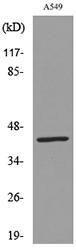 Western blot analysis of lysate from A549 cells using Anti-KRT19 Antibody