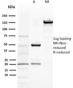 SDS-PAGE analysis of Anti-BAP1 Antibody [BAP1/2432] under non-reduced and reduced conditions; showing intact IgG and intact heavy and light chains, respectively. SDS-PAGE analysis confirms the integrity and purity of the Antibody