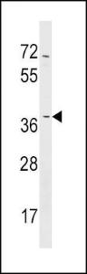 Anti-NMNAT2 Rabbit Polyclonal Antibody (APC (Allophycocyanin))