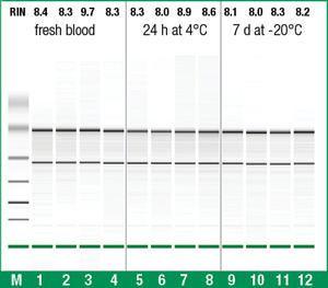 Whole Blood RNA Purification Mini kit, GeneJET™