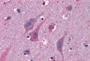 Anti-MYRIP Antibody (A83946) (3.75 µg/ml) staining of paraffin embedded Human Cortex. Steamed antigen retrieval with citrate buffer pH 6, AP-staining