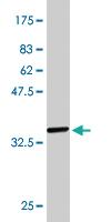 Anti-PTK7 Mouse Monoclonal Antibody [clone: 4D4]