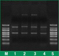 Whole Blood RNA Purification Mini kit, GeneJET™