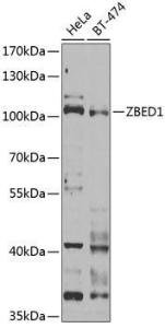 Western blot analysis of extracts of various cell lines, using Anti-DREF Antibody (A9996) at 1:1,000 dilution The secondary antibody was Goat Anti-Rabbit IgG H&L Antibody (HRP) at 1:10,000 dilution Lysates/proteins were present at 25 µg per lane