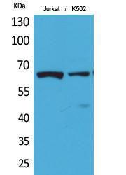 Western blot analysis of Jurkat, K562 cells using Anti-NFκB-p65 (acetyl Lys218) Antibody