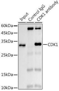 Immunoprecipitation analysis of 300µg extracts of 293T cells using 3µg of Anti-CDK1 Antibody [ARC50607] (A305462). This Western blot was performed on the immunoprecipitate using Anti-CDK1 Antibody [ARC50607] (A305462) at a dilution of1:1000.