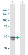 Anti-MMP20 Rabbit Polyclonal Antibody