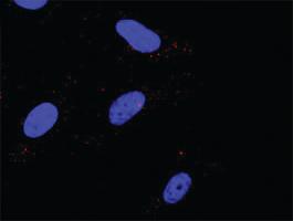 Anti-PRL + PRL Antibody Pair