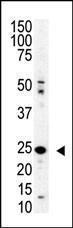 Anti-SENP8 Rabbit Polyclonal Antibody (AP (Alkaline Phosphatase))