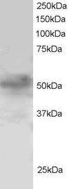 Anti-FOXQ1 antibody